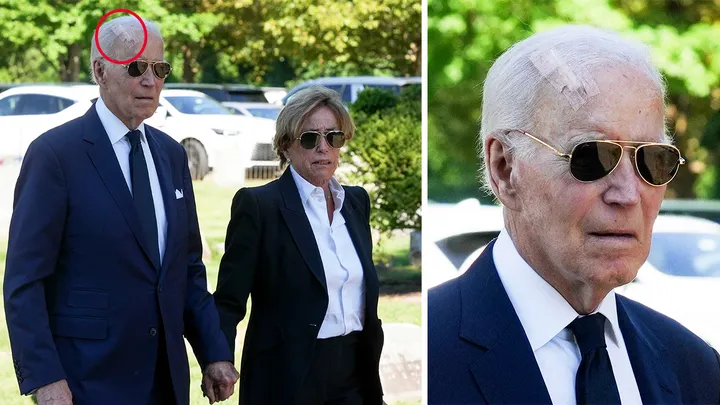 Former President Joe Biden was spotted with a bandage in late August while attending the funeral for former Delaware Gov. and U.S. Rep. Mike Castle at St. Joseph on the Brandywine Church in Greenville. (William Bretzger-Delaware News Journal/USA Today Network via Imagn Images)