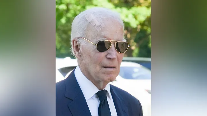Former President Joe Biden sported a giant bandage on his head in late August. A spokesperson for Biden confirmed he had Mohs surgery to treat skin cancer. (William Bretzger-Delaware News Journal/USA Today Network via Imagn Images)