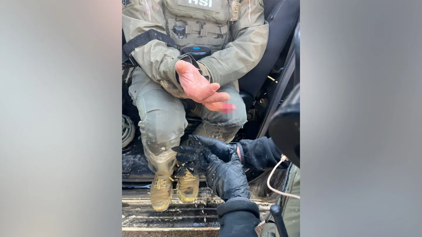 Anti-ICE Rioter Bites Off Federal Officer’s Finger as Minneapolis Chaos Spirals Out of Control