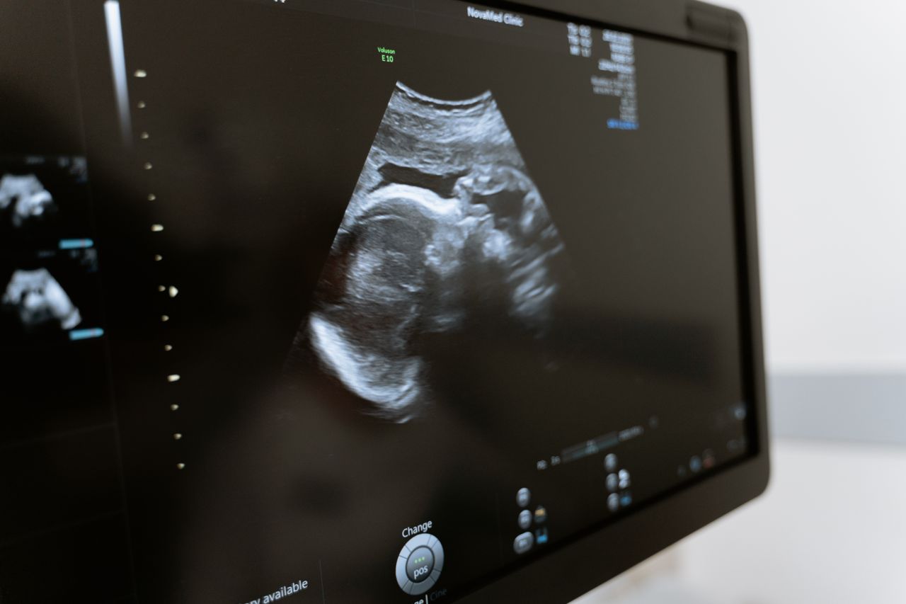 Ninth Circuit Halts Rogue Judge's Abortion Edict, Defending Idaho's Pro-Life Protections